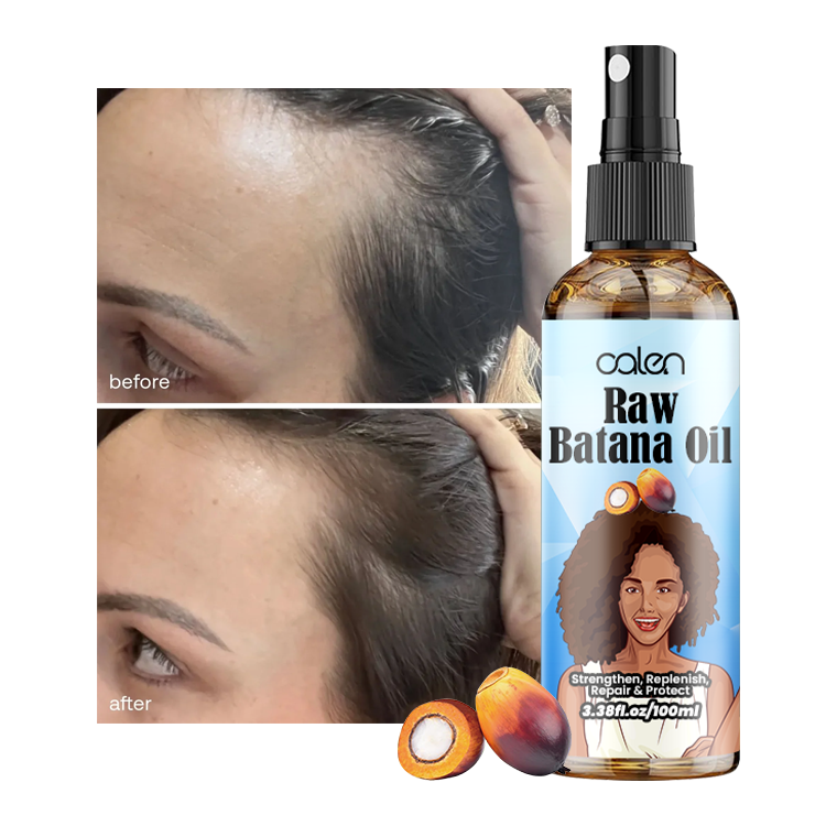 Luxfume 100Ml Anti Hair Loss Strengthen Raw Batana Oil Spray,oalen cosmetics