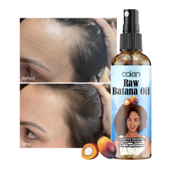 Luxfume 100Ml Anti Hair Loss Strengthen Raw Batana Oil Spray,oalen cosmetics