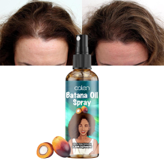 Oalen Private Label 100Ml Hair Regrowth Anti Loss Batana Oil Spray,MY SHOP