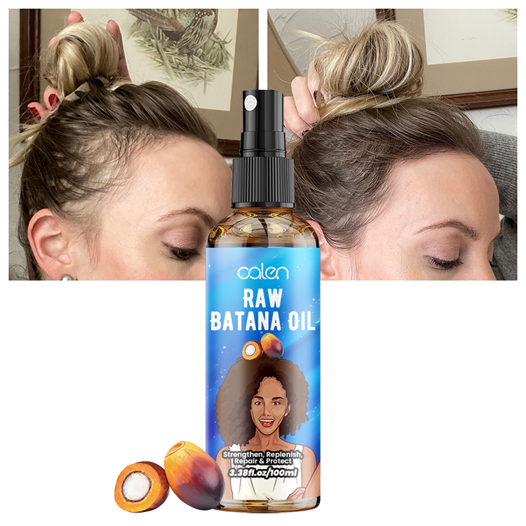 Oalen Custom Logo 100Ml Hair Growth Scalp Serum Batana Oil Spray,MY SHOP