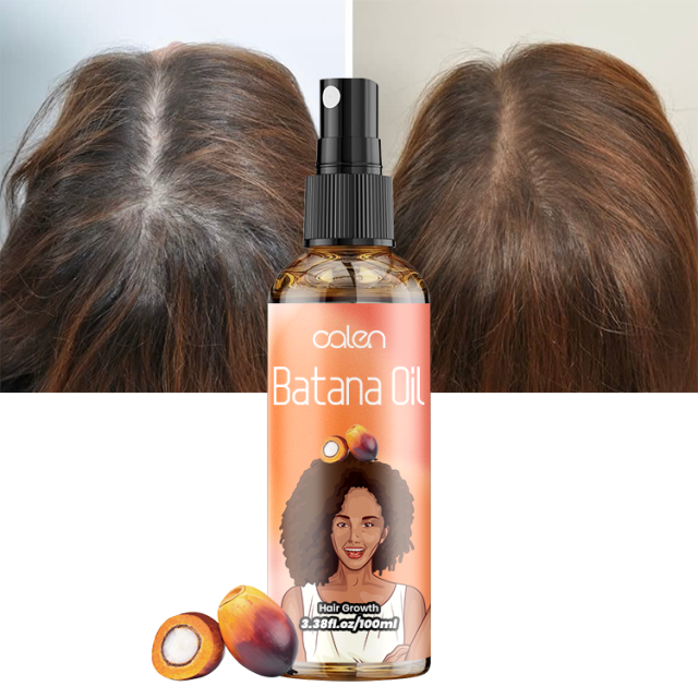 Oalen 120Ml Hair Growth Promotes Hair Wellness Batana Oil Spray,MY SHOP