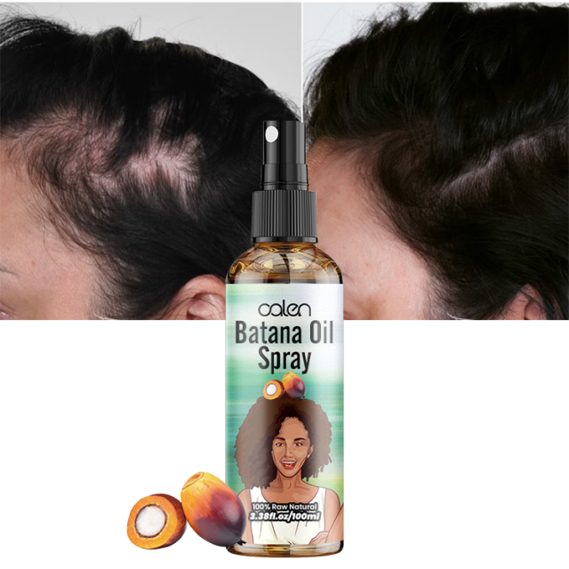 Luxfume 120Ml Repair Nourishing Anti Hair Loss Raw Batana Oil,oalen cosmetics