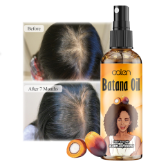 100Ml Luxfume Natual Promotes Hair Growth Batana Oil Spray For Hair,MY SHOP