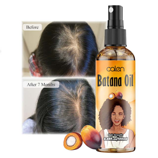 100Ml Luxfume Natual Promotes Hair Growth Batana Oil Spray For Hair,MY SHOP