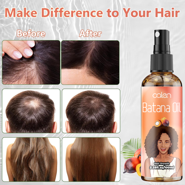 Oalen 120Ml Hair Growth Promotes Hair Wellness Batana Oil Spray,MY SHOP