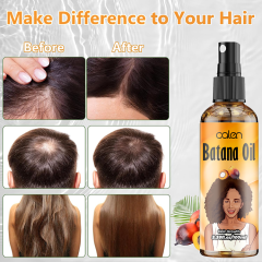 100Ml Luxfume Natual Promotes Hair Growth Batana Oil Spray For Hair,MY SHOP