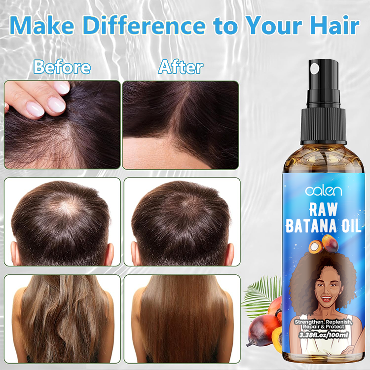 Oalen Custom Logo 100Ml Hair Growth Scalp Serum Batana Oil Spray,MY SHOP