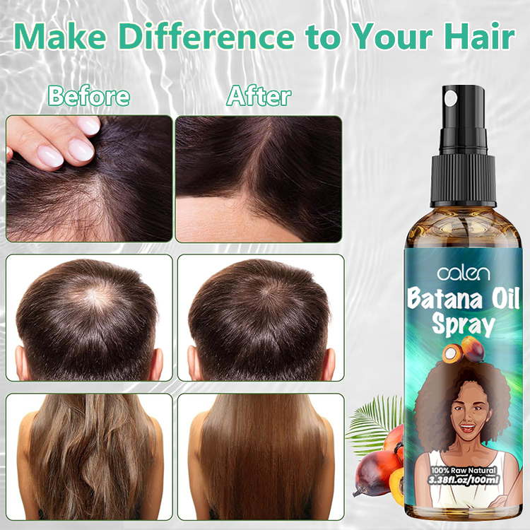 Oalen Private Label 100Ml Hair Regrowth Anti Loss Batana Oil Spray,MY SHOP