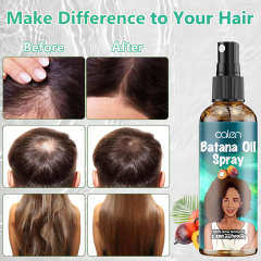 Oalen Private Label 100Ml Hair Regrowth Anti Loss Batana Oil Spray,MY SHOP