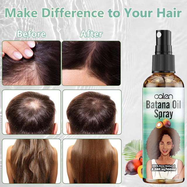 Luxfume 120Ml Repair Nourishing Anti Hair Loss Raw Batana Oil,oalen cosmetics