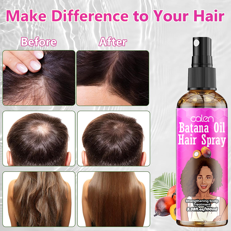 Luxfume 100Ml Anti Loss Treatment Natural Raw Batana Oil Hair Spray,oalen cosmetics
