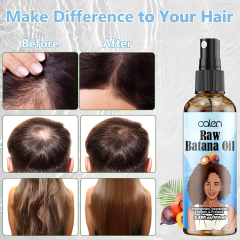 Luxfume 100Ml Anti Hair Loss Strengthen Raw Batana Oil Spray,oalen cosmetics