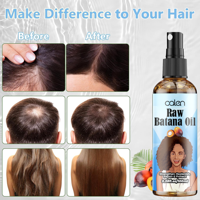 Luxfume 100Ml Anti Hair Loss Strengthen Raw Batana Oil Spray,oalen cosmetics