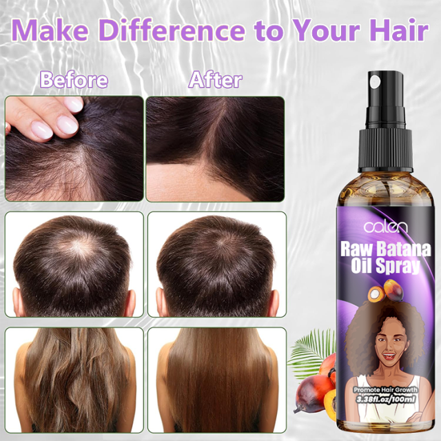 Oalen 100Ml Custom Label Hair Regrowth Treatment Raw Batana Oil Spray,MY SHOP
