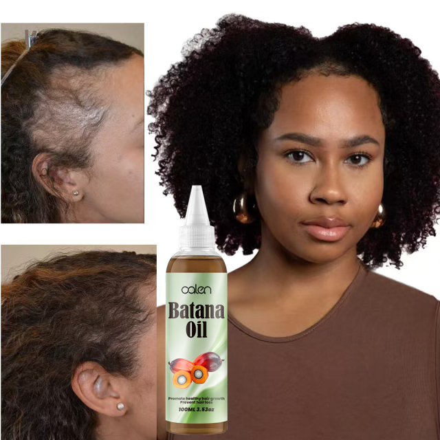 Luxfume Batana Hair Oil Prevents Hair Loss And Grows Hair Thickness For Men And Women,oalen cosmetics
