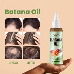 Luxfume Batana Hair Oil Prevents Hair Loss And Grows Hair Thickness For Men And Women,oalen cosmetics