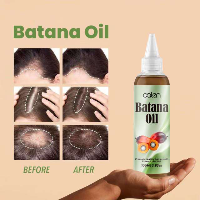 Luxfume Batana Hair Oil Prevents Hair Loss And Grows Hair Thickness For Men And Women,oalen cosmetics