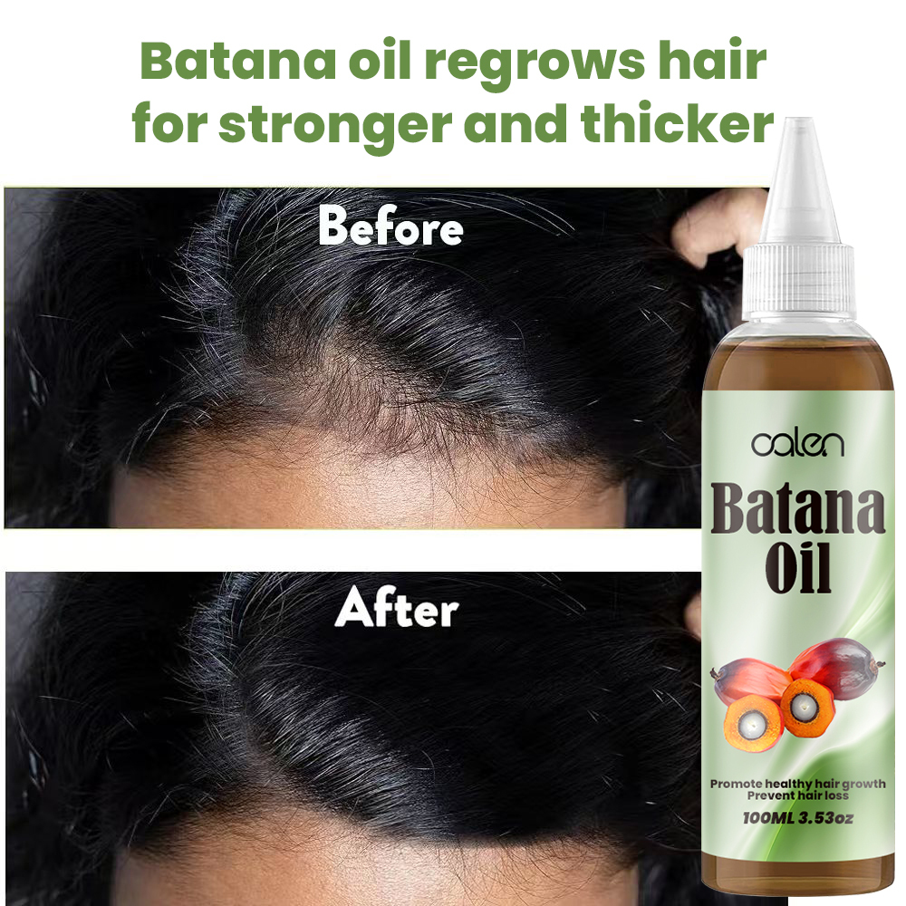 Luxfume Batana Hair Oil Prevents Hair Loss And Grows Hair Thickness For Men And Women,oalen cosmetics
