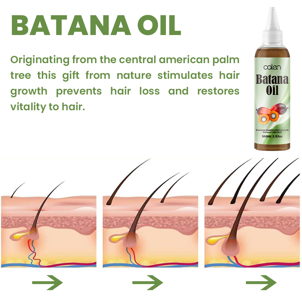 Luxfume Batana Hair Oil Prevents Hair Loss And Grows Hair Thickness For Men And Women,oalen cosmetics