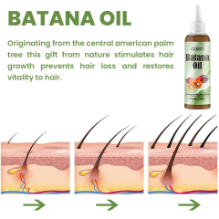Luxfume Batana Hair Oil Prevents Hair Loss And Grows Hair Thickness For Men And Women,oalen cosmetics