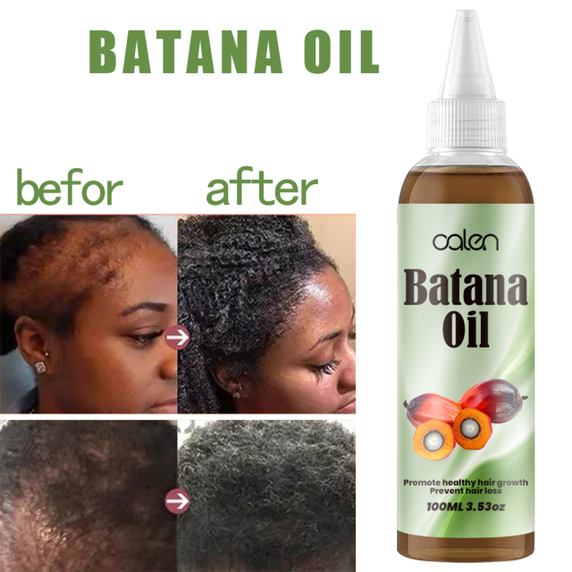 Luxfume Batana Hair Oil Prevents Hair Loss And Grows Hair Thickness For Men And Women,oalen cosmetics