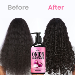 Luxfume Onion Conditioner Enhances Shine Promotes Hair Growth Restores Vitality To Thinning Hair,MY SHOP