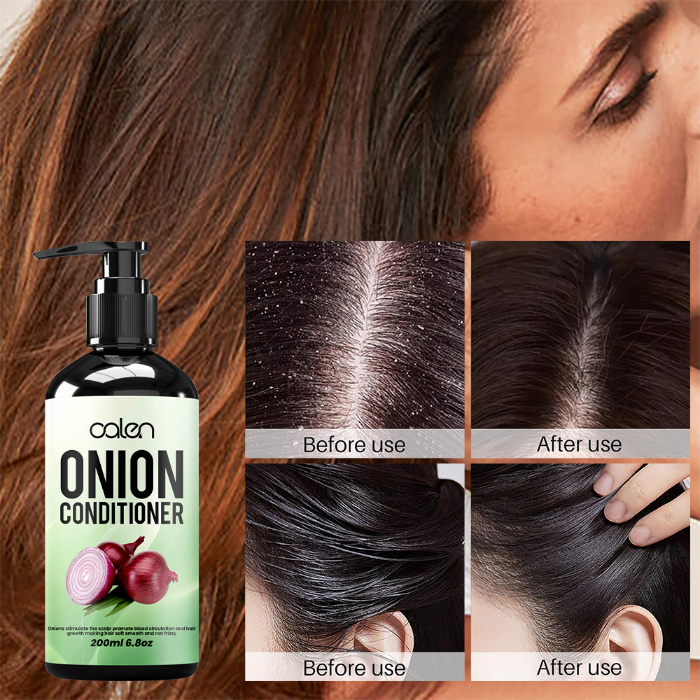 Luxfume 200ml Adds Shine And Volume To Hair Controls Frizz Moisturizes Damaged Hair Onion Conditioner,oalen cosmetics