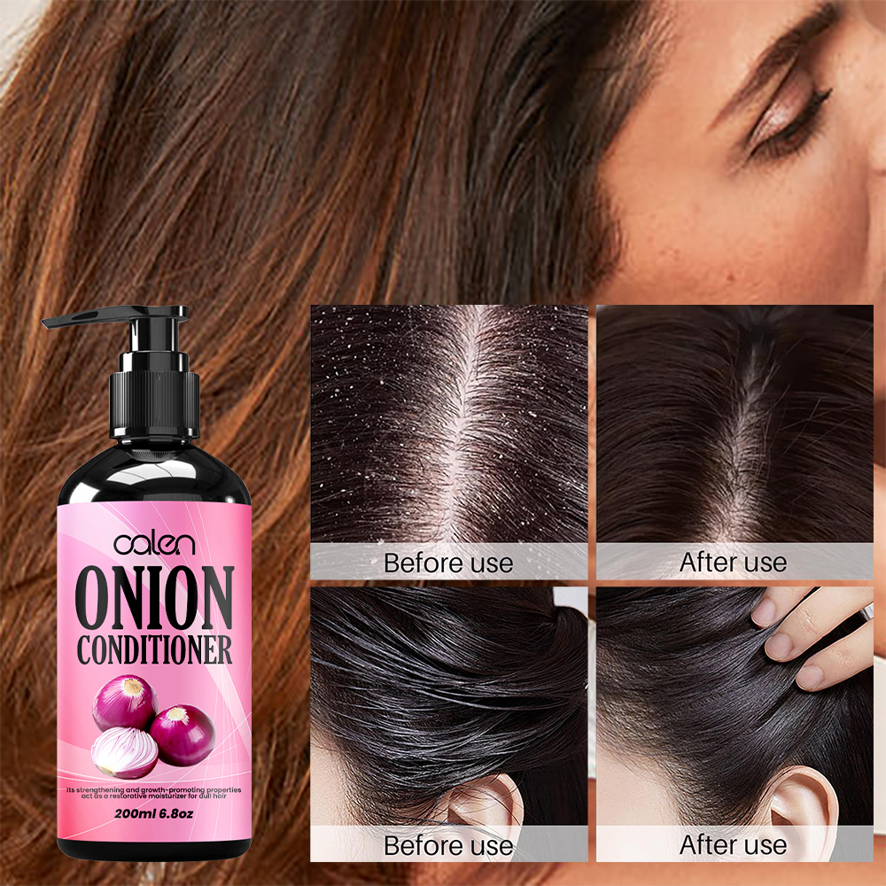 Luxfume Onion Conditioner Enhances Shine Promotes Hair Growth Restores Vitality To Thinning Hair,MY SHOP