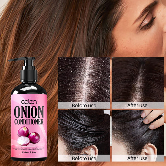 Luxfume Onion Conditioner Enhances Shine Promotes Hair Growth Restores Vitality To Thinning Hair,MY SHOP