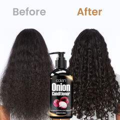 Luxfume 200ml Onion Conditioner Reduces Scalp Itch Dandruff and Frizz Suitable for Everyone,MY SHOP