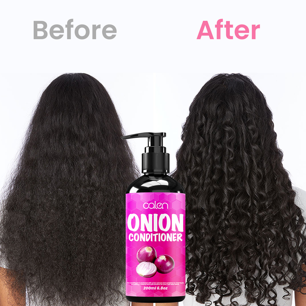 Luxfume Private Label Onion Conditioner Deep Care For Dry and Damaged Hair For Men and Women,MY SHOP