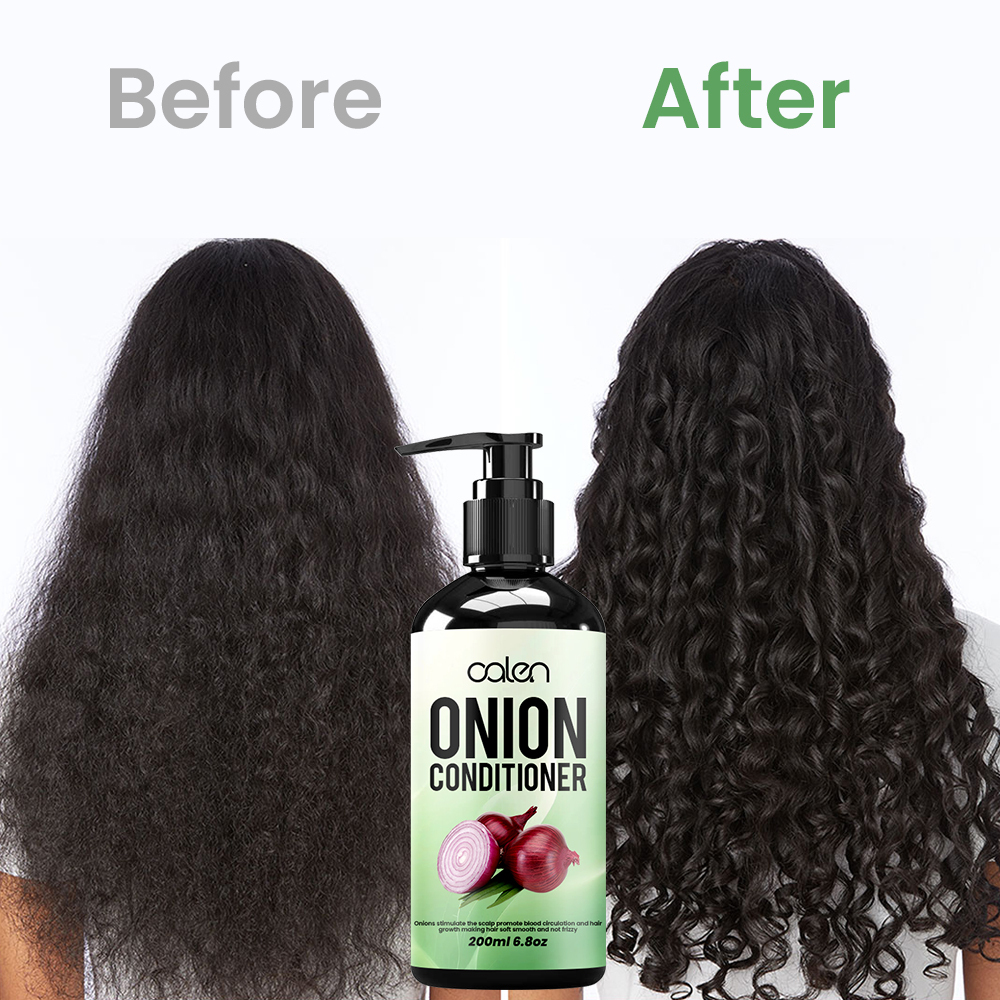 Luxfume 200ml Onion Leave-In Conditioner Anti-Hair Loss Deep Treatment Dry Damaged Hair,MY SHOP