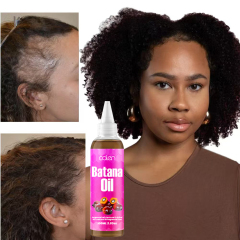Luxfume Batana Organic Hair Growth Oil Prevents Hair Loss And Eliminates Split Ends For All Hair Types,MY SHOP