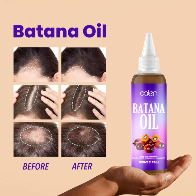 Luxfume Batana Hair Oil Prevents Hair Loss And Grows Hair Thickness For Men And Women,MY SHOP