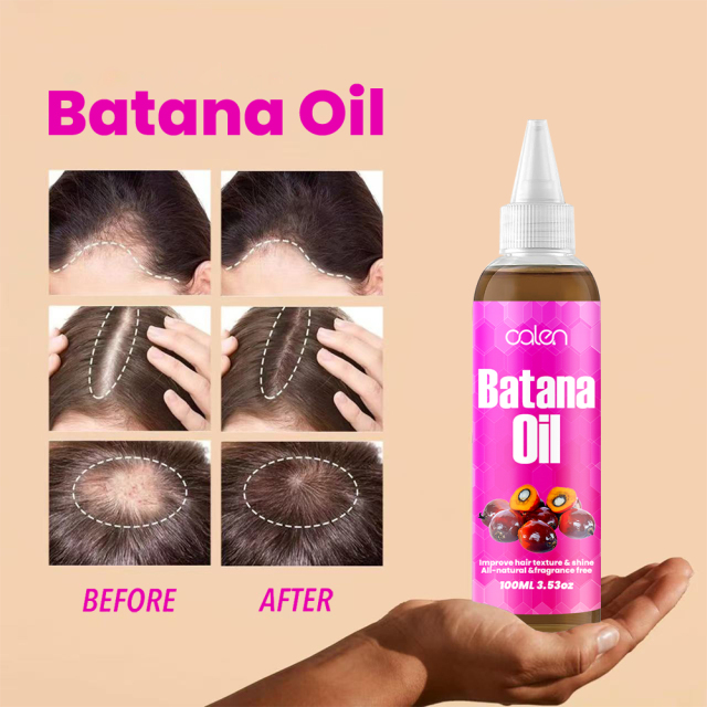 Luxfume Batana Organic Hair Growth Oil Prevents Hair Loss And Eliminates Split Ends For All Hair Types,MY SHOP