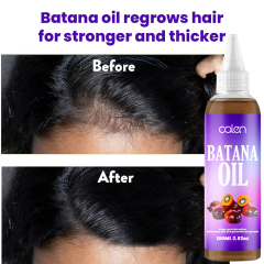 Luxfume Batana Hair Oil Prevents Hair Loss And Grows Hair Thickness For Men And Women,MY SHOP