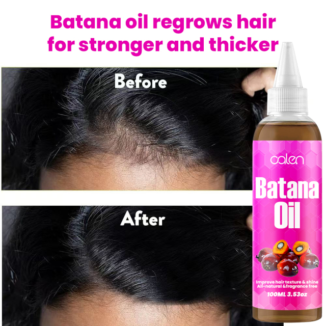 Luxfume Batana Organic Hair Growth Oil Prevents Hair Loss And Eliminates Split Ends For All Hair Types,MY SHOP