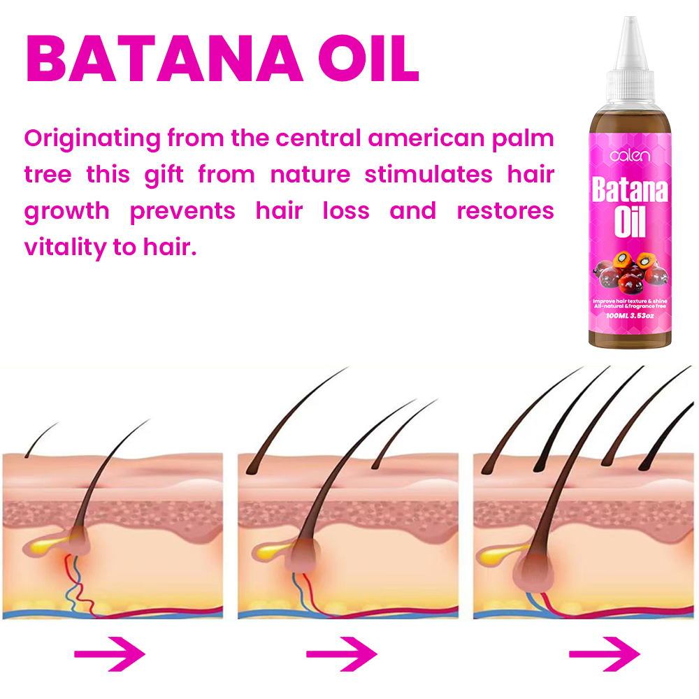 Luxfume Batana Organic Hair Growth Oil Prevents Hair Loss And Eliminates Split Ends For All Hair Types,MY SHOP