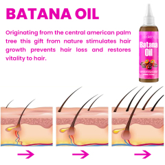 Luxfume Batana Organic Hair Growth Oil Prevents Hair Loss And Eliminates Split Ends For All Hair Types,MY SHOP