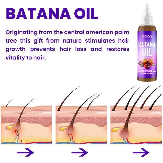 Luxfume Batana Hair Oil Prevents Hair Loss And Grows Hair Thickness For Men And Women,MY SHOP