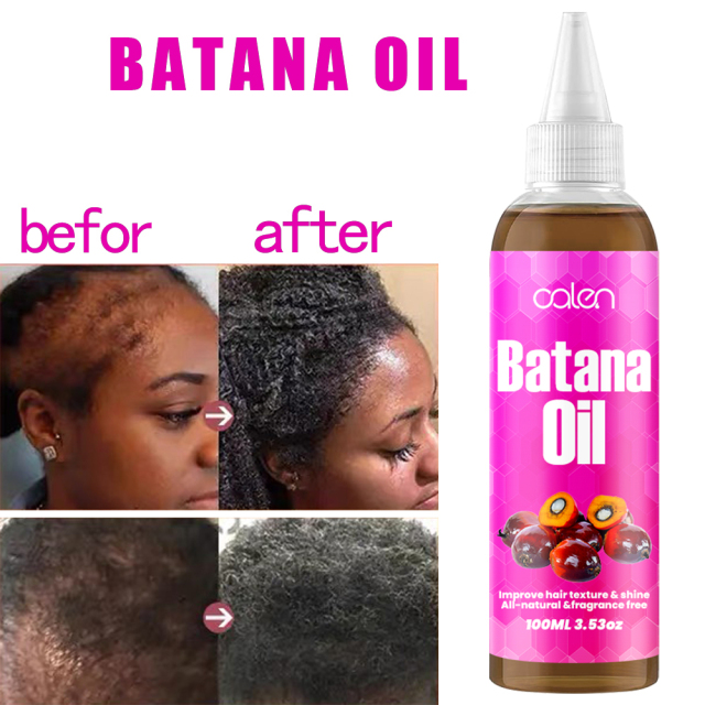 Luxfume Batana Organic Hair Growth Oil Prevents Hair Loss And Eliminates Split Ends For All Hair Types,MY SHOP