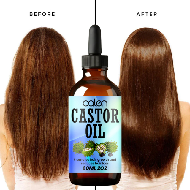Luxfume Grows Thick Hair While Reducing Hair Loss Castor Oil,MY SHOP