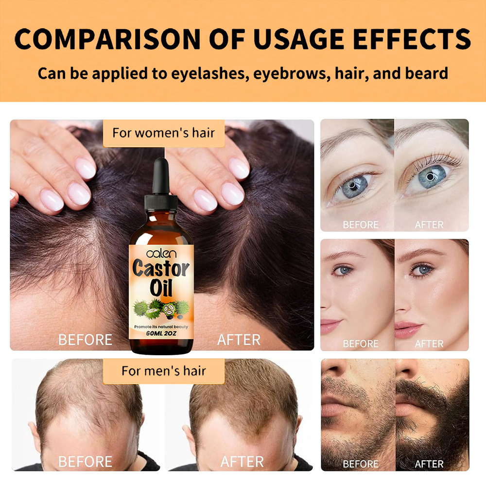 Luxfume Stimulates Hair, Eyelash, Eyebrow Growth Castor Oil,oalen cosmetics