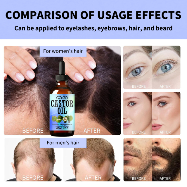 Luxfume Grows Thick Hair While Reducing Hair Loss Castor Oil,MY SHOP