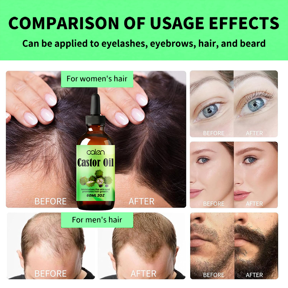 Luxfume Hair Strengthening Eyelash and Eyebrow Growth Serum Castor Oil,MY SHOP