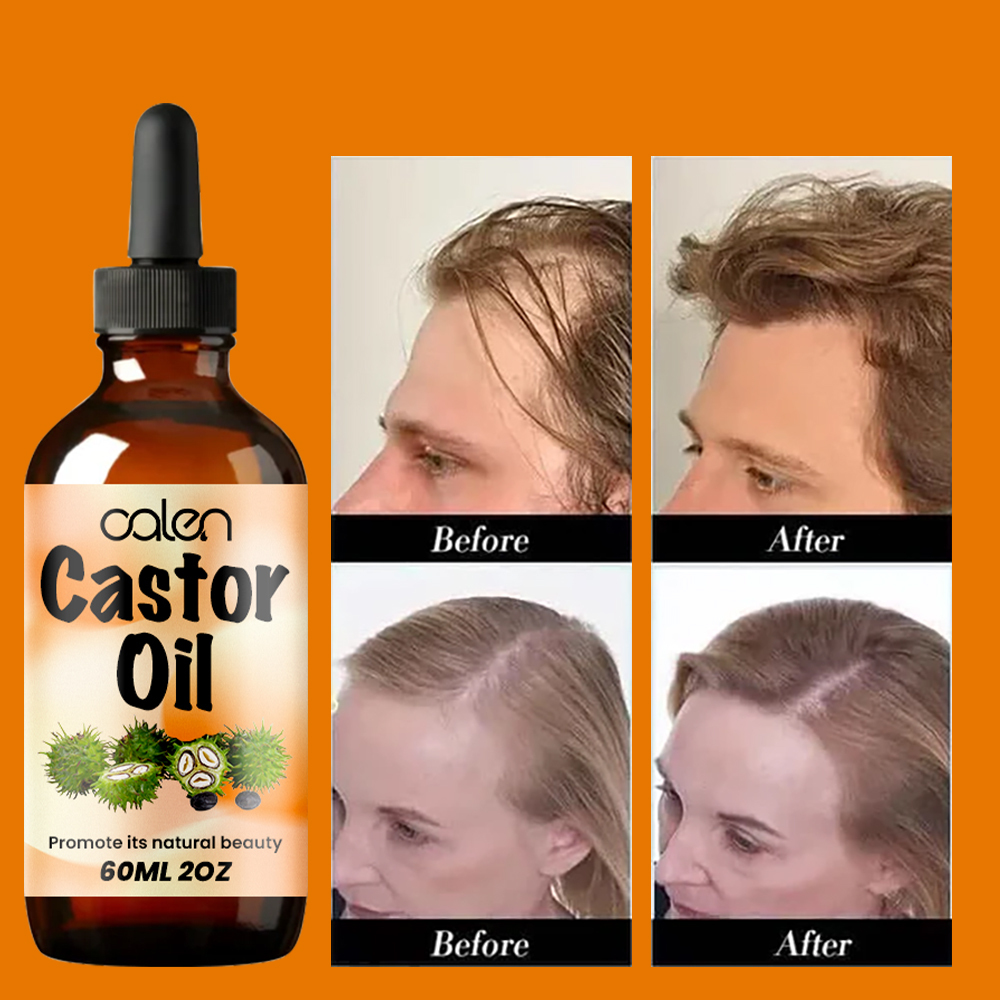 Luxfume Stimulates Hair, Eyelash, Eyebrow Growth Castor Oil,oalen cosmetics