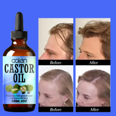 Luxfume Grows Thick Hair While Reducing Hair Loss Castor Oil,MY SHOP