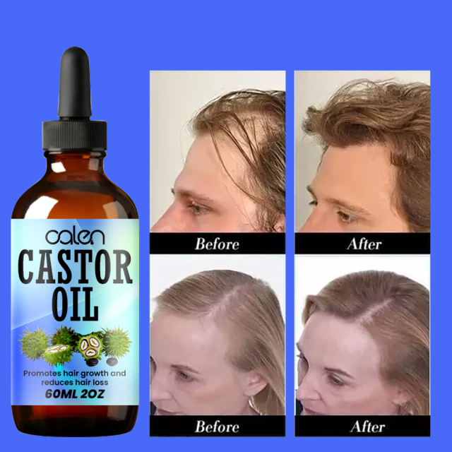 Luxfume Grows Thick Hair While Reducing Hair Loss Castor Oil,MY SHOP