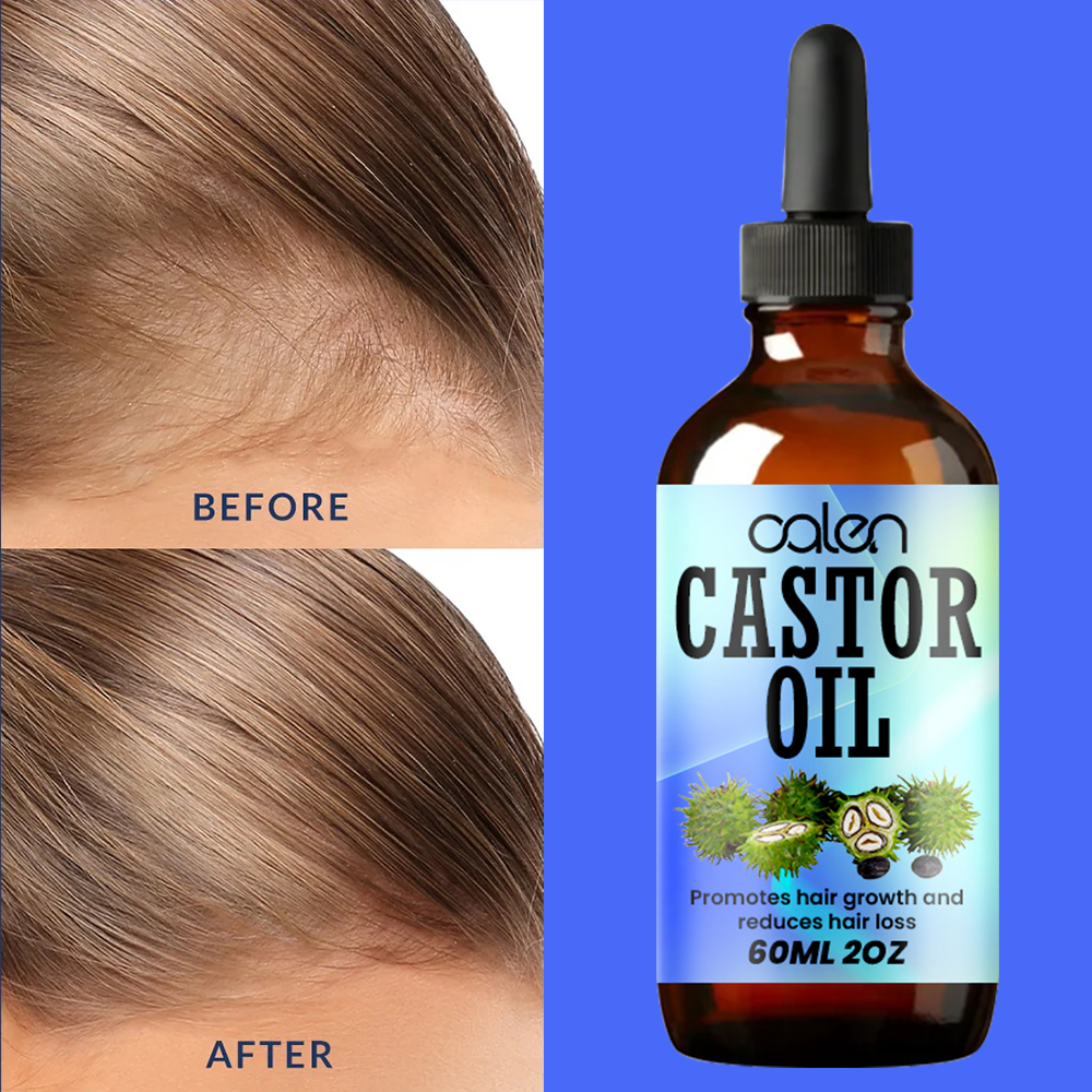 Luxfume Grows Thick Hair While Reducing Hair Loss Castor Oil,MY SHOP
