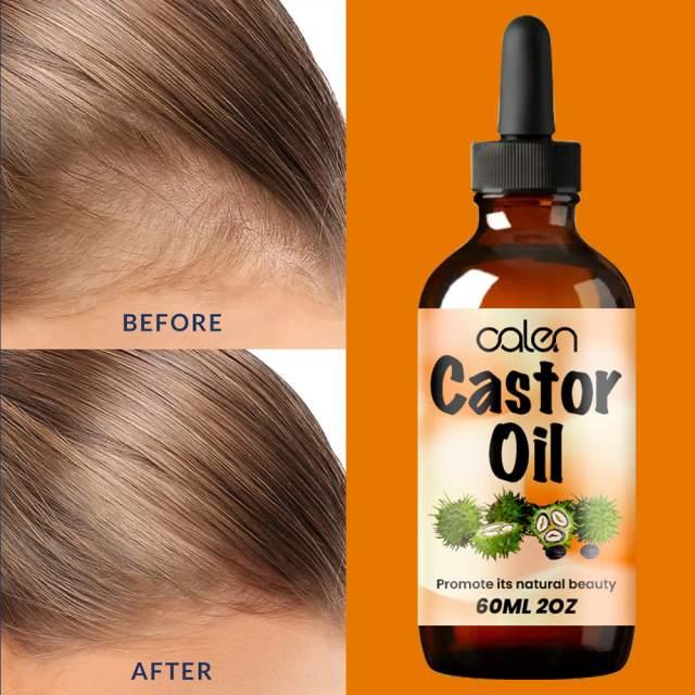 Luxfume Stimulates Hair, Eyelash, Eyebrow Growth Castor Oil,oalen cosmetics